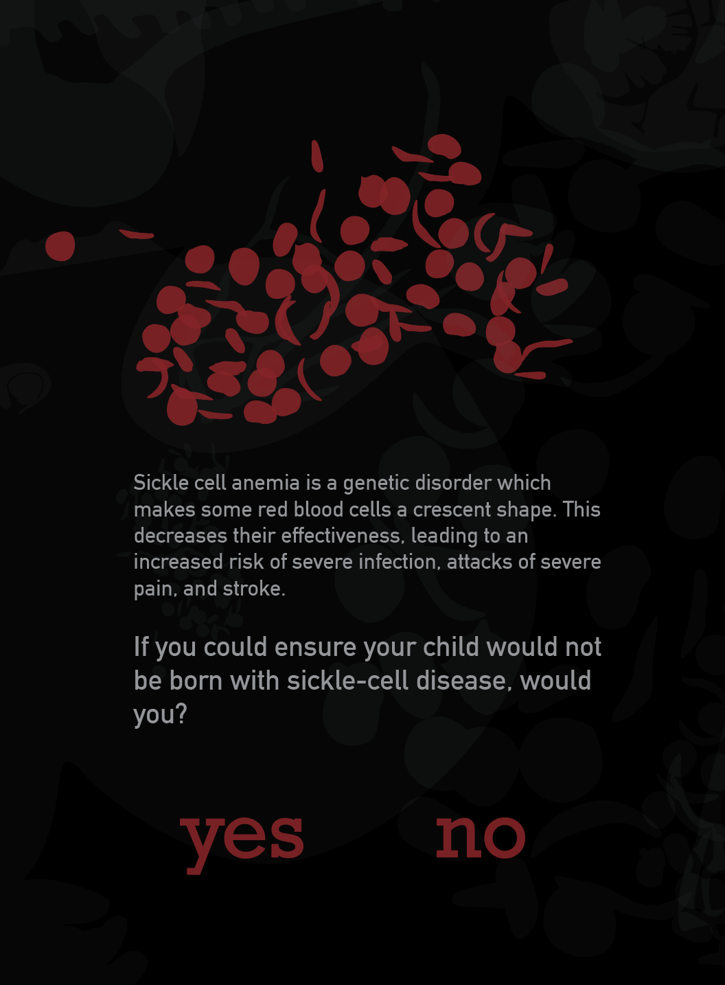Sickle Cell Disease Prevention Question Interface